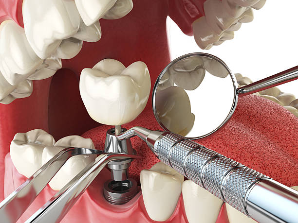 Best Emergency Root Canal Treatment in Taft, CA