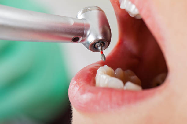 Best Emergency Dentist for Lost Fillings or Crowns in Taft, CA